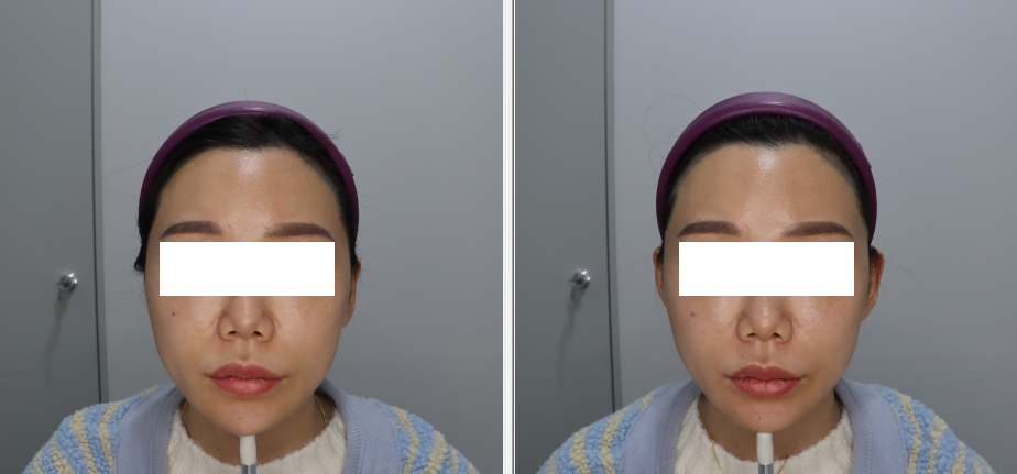 귀 존재감 뿜뿜, 너무 만족스러워요.