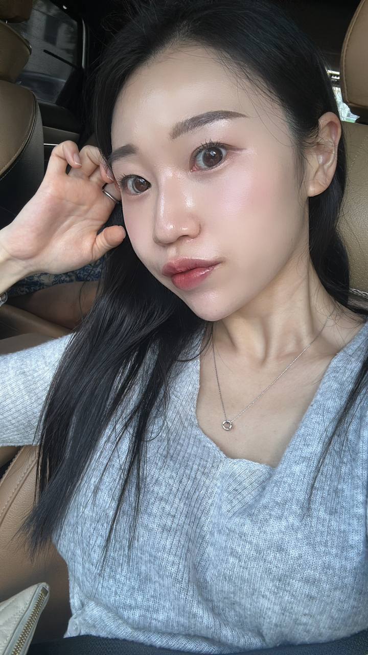 입술필러+턱끝필러 만족 후기