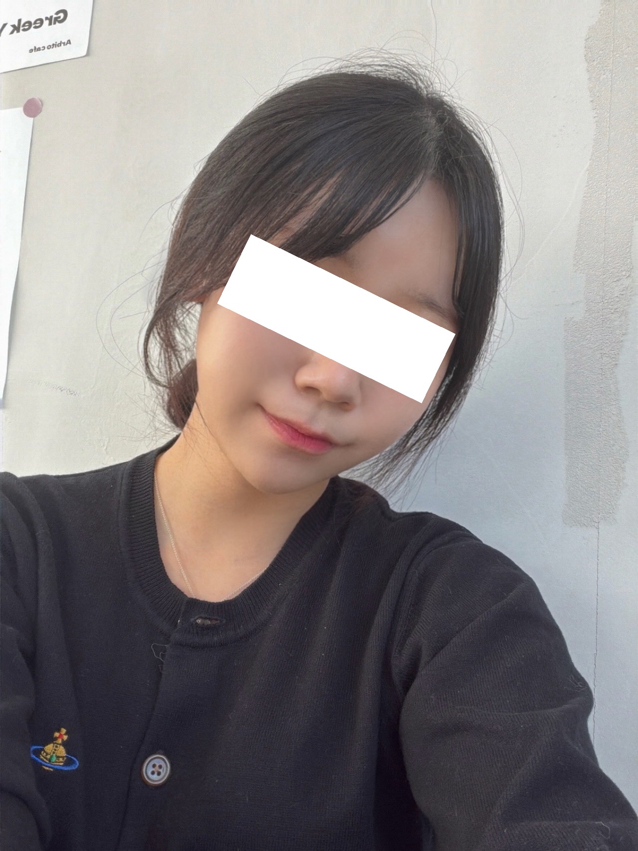 이마 필러 후기에용