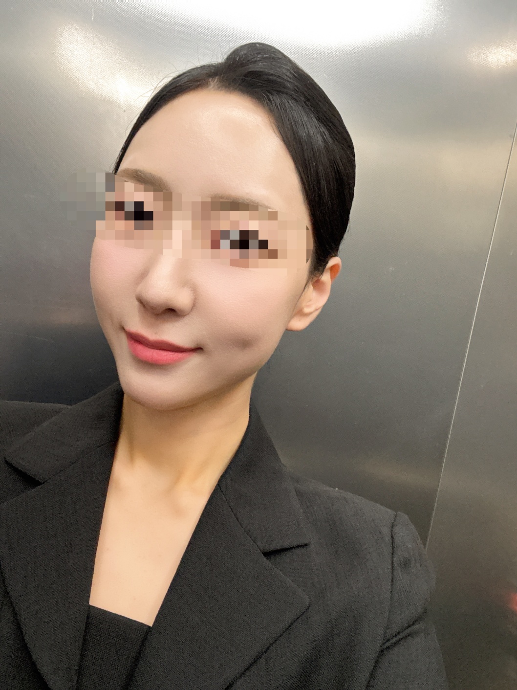 3년만에 이마필러 조금 더 채워넣었어요