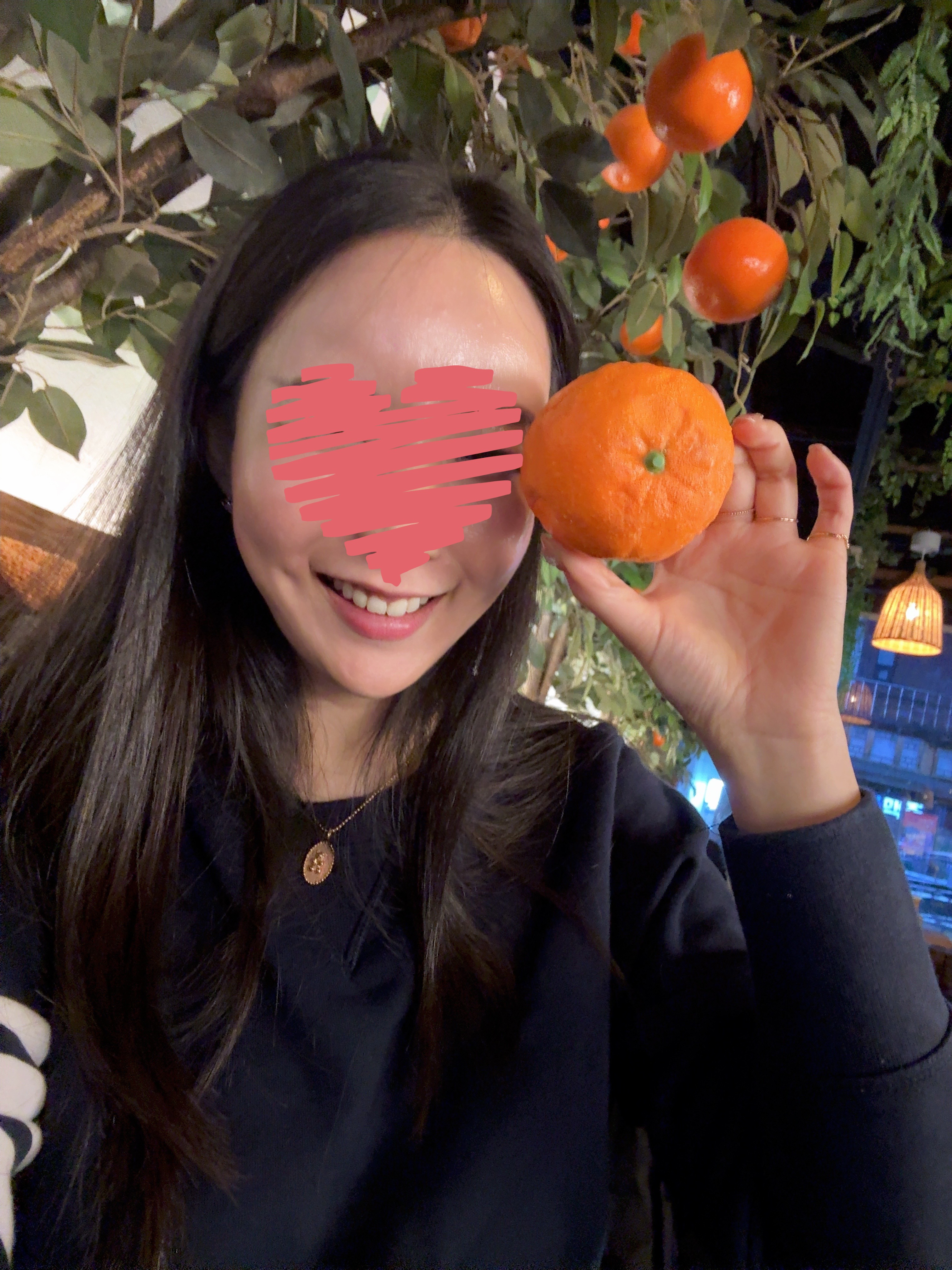 쥬베룩 스킨 5cc 시술하고 3주차 후기