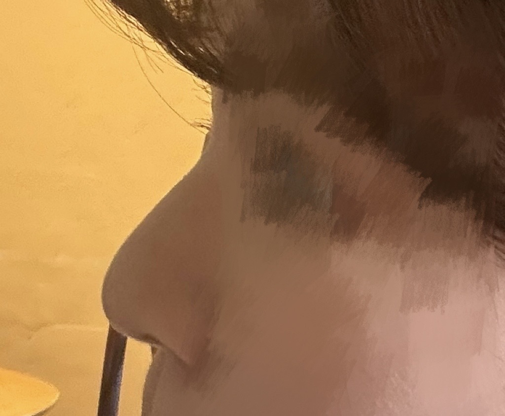하이코실 후기