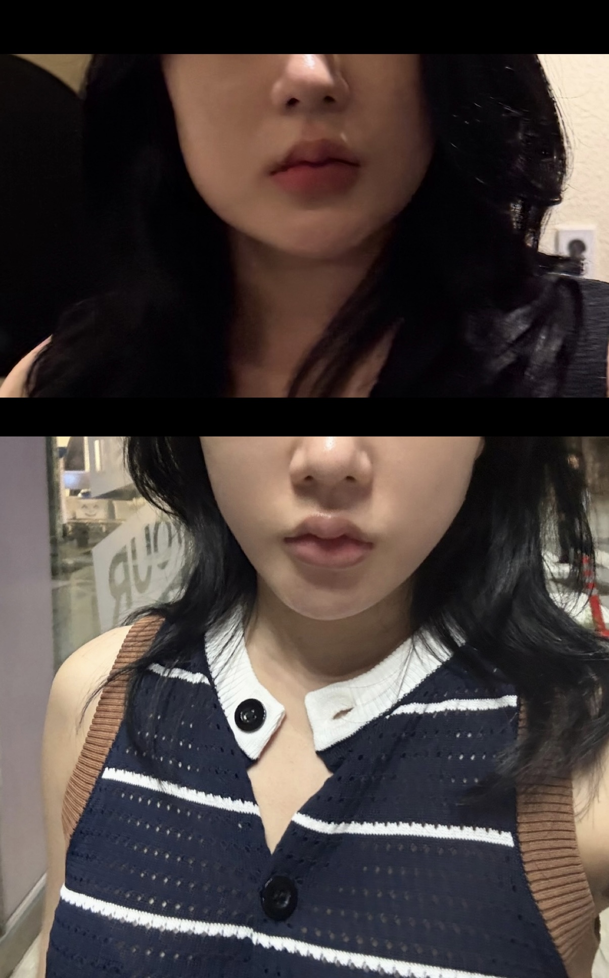 실리프팅