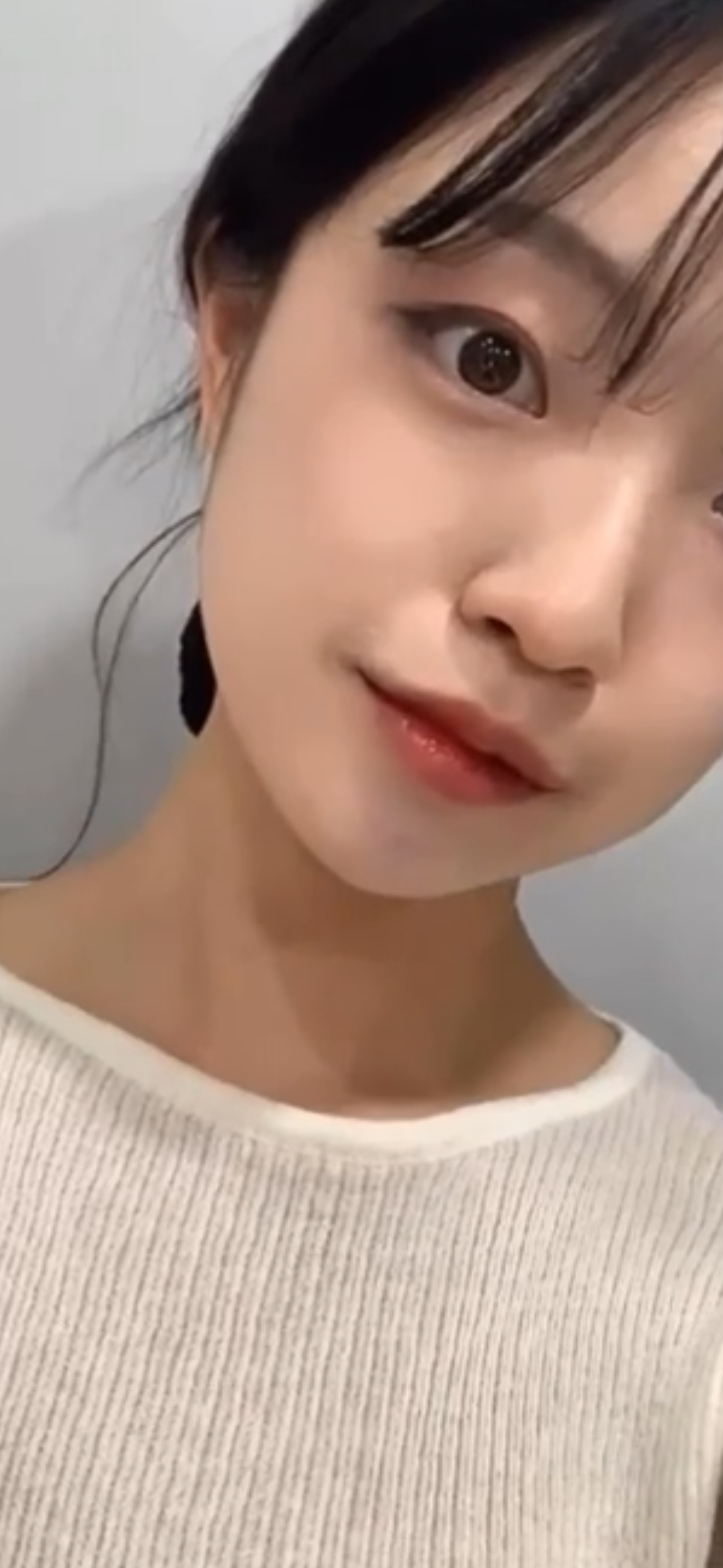 입술필러