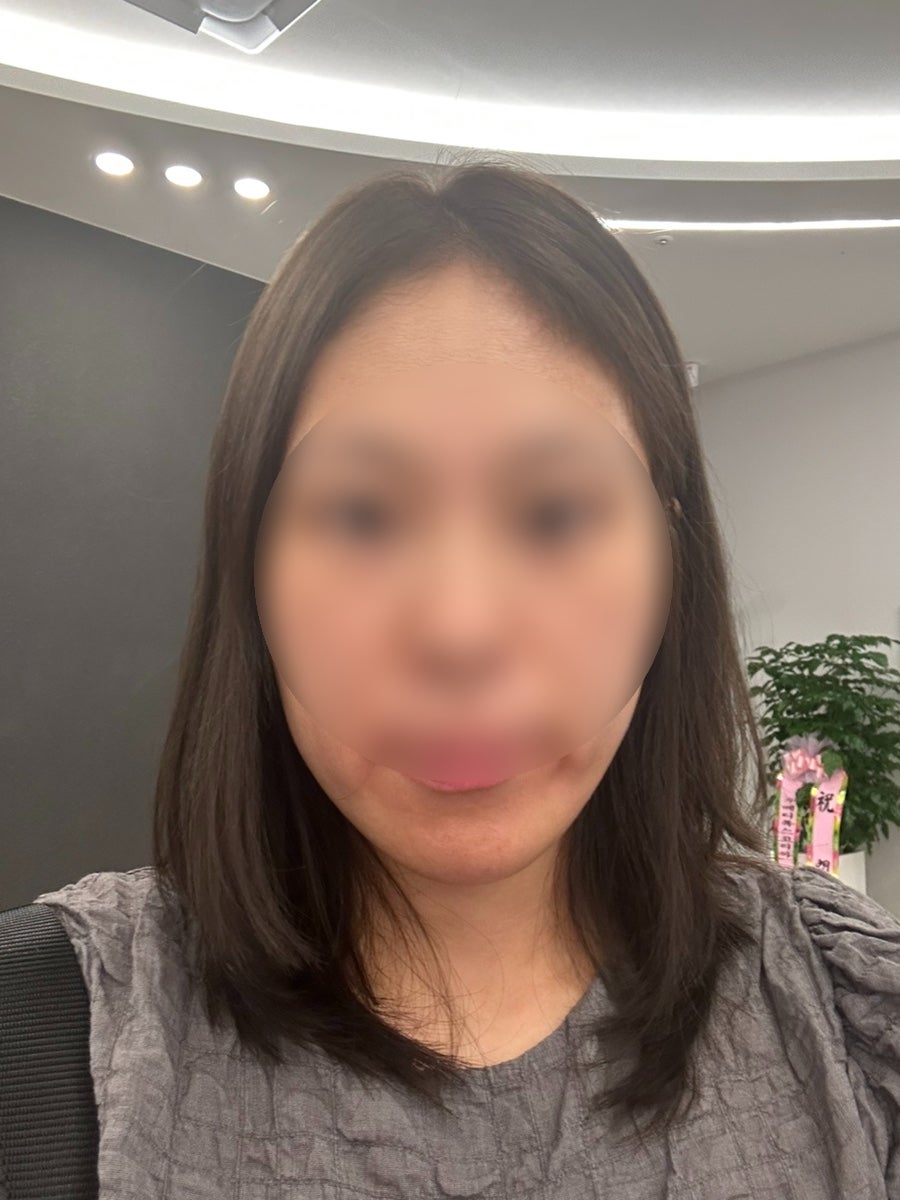 온다리프팅 시술 만족