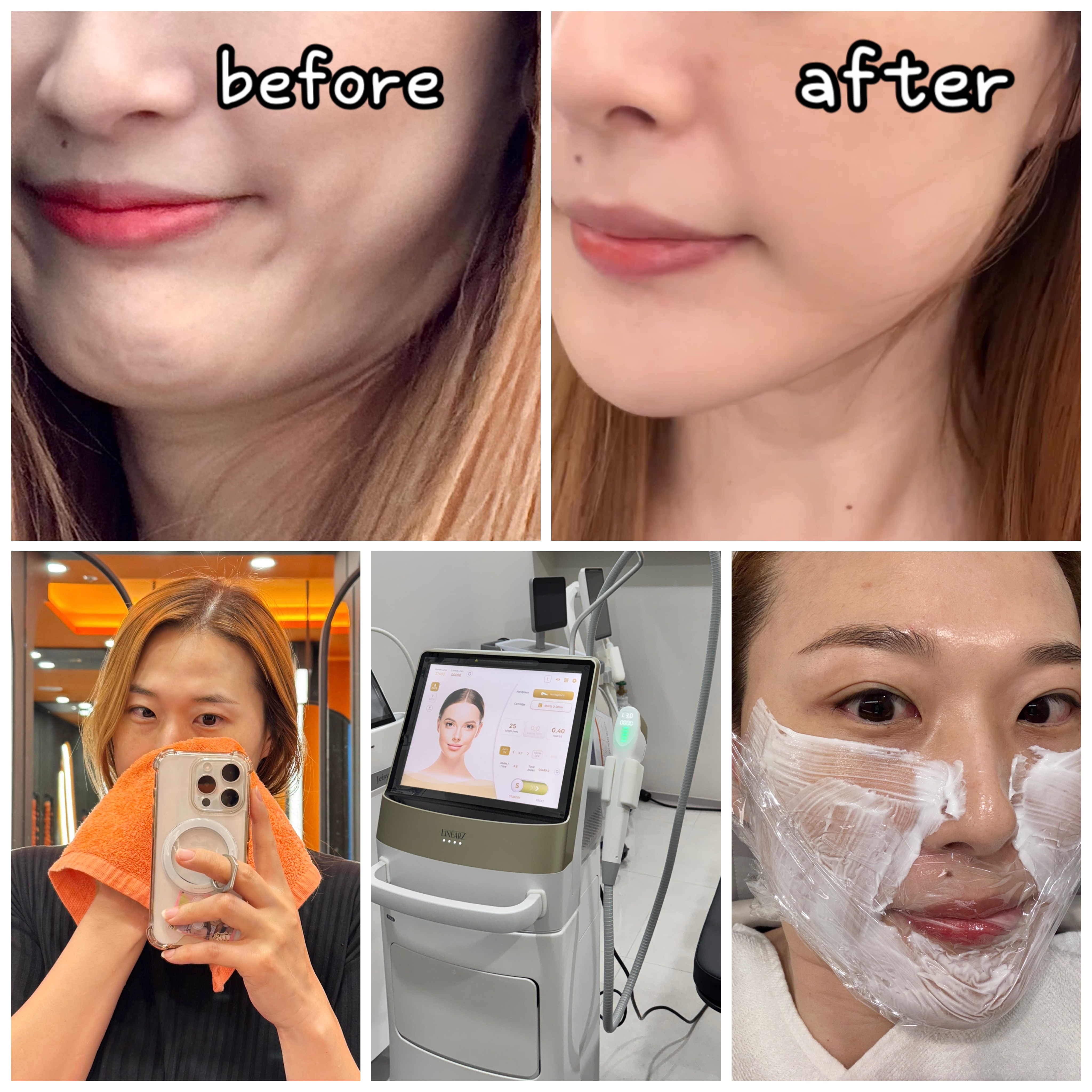 진주미미썸 리니어지 500샷 후기