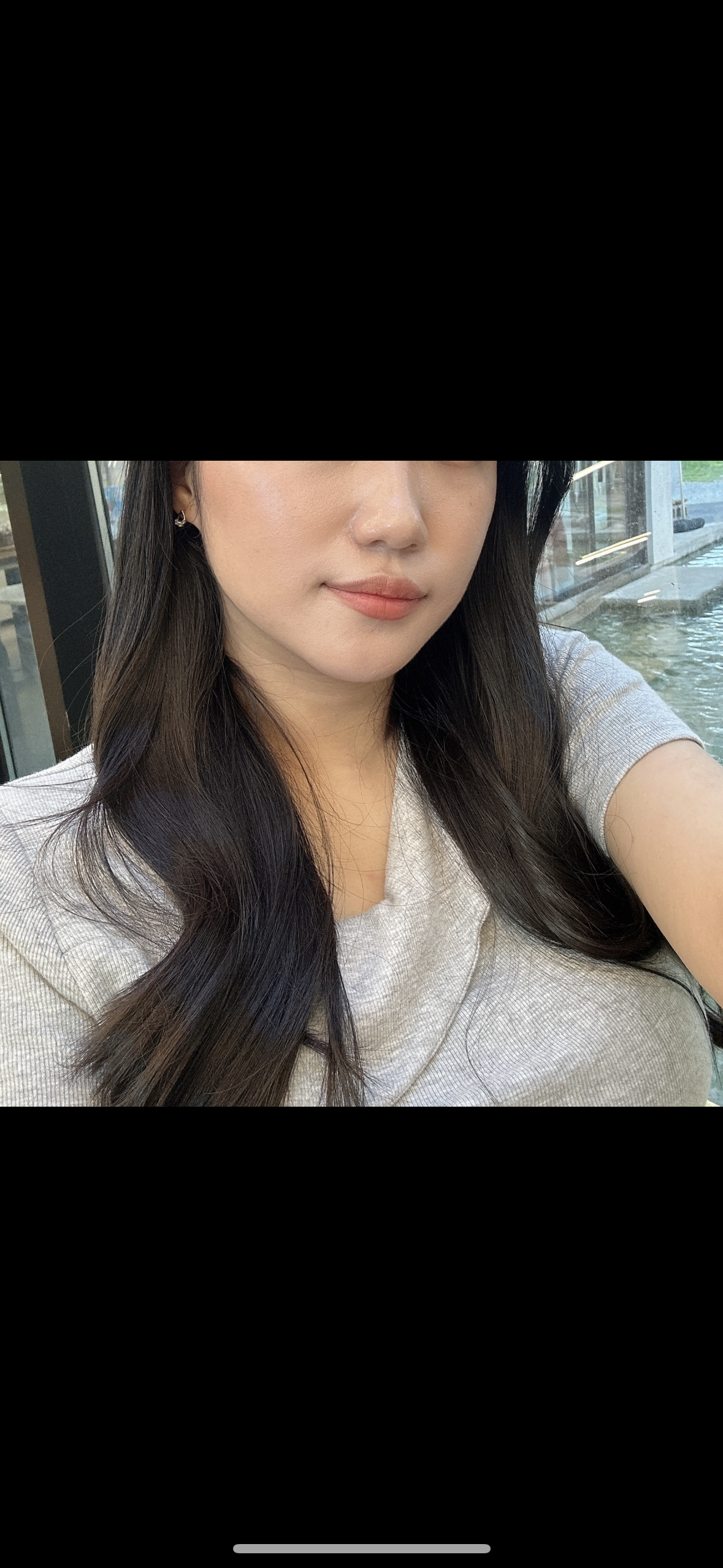 진주점에서 필러 맞고 왔어요~