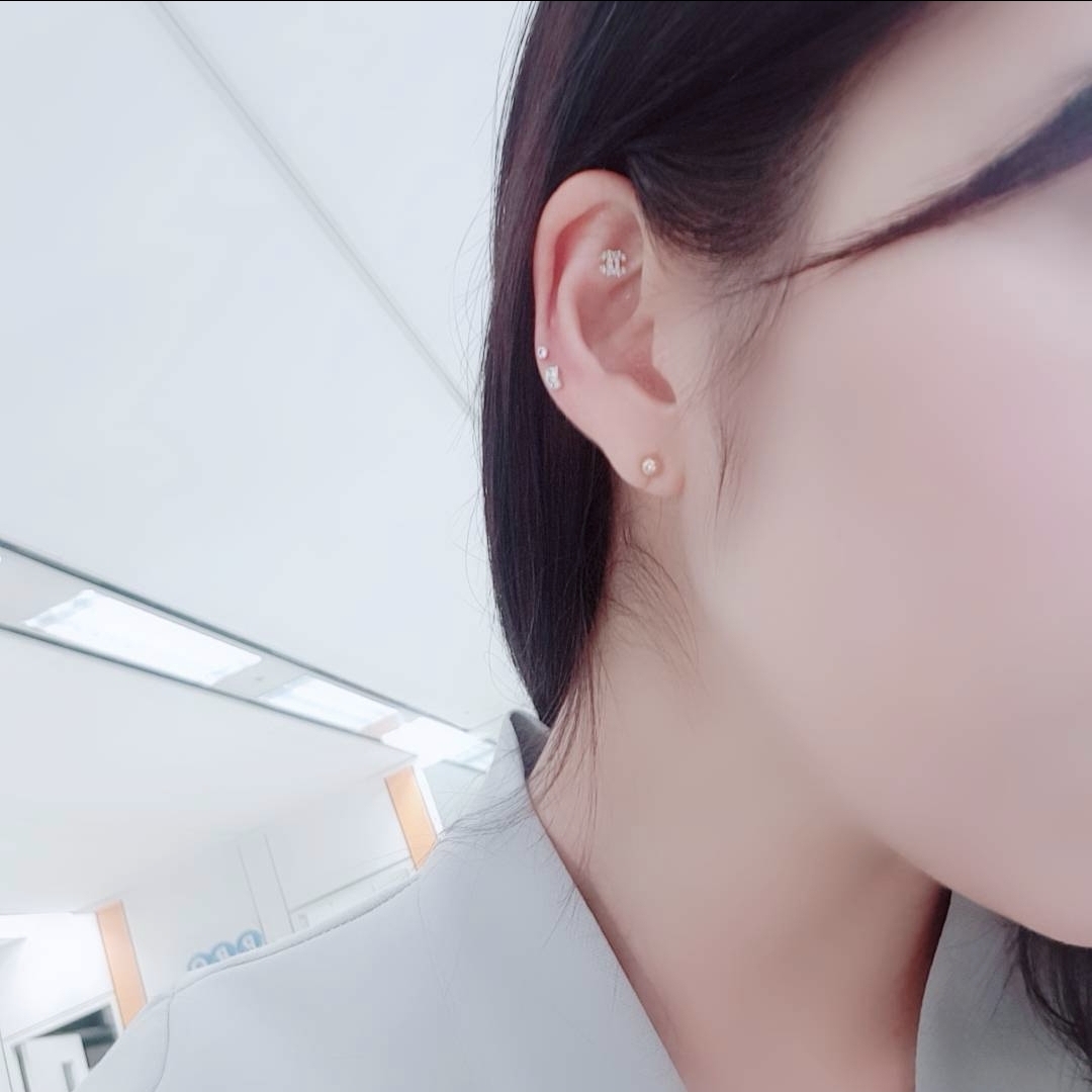 귓볼 귓바퀴 필러 했어요
